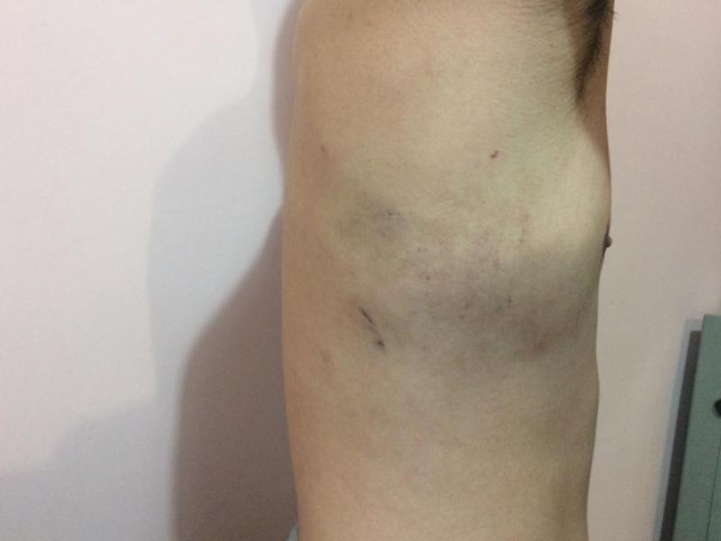 Институт Омбудсмена КР: пытки возле здания Правительства КР