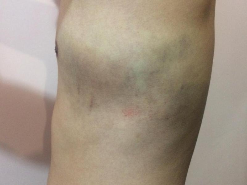 Институт Омбудсмена КР: пытки возле здания Правительства КР